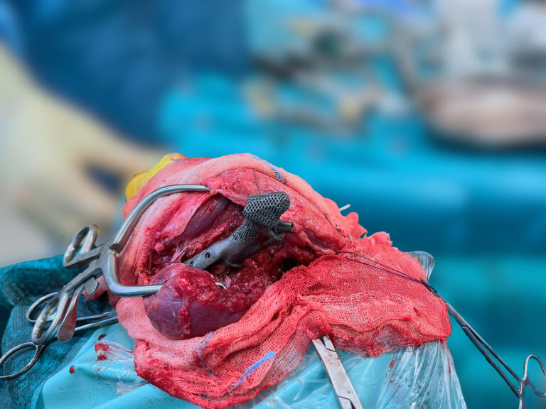 Implantat eingebaut