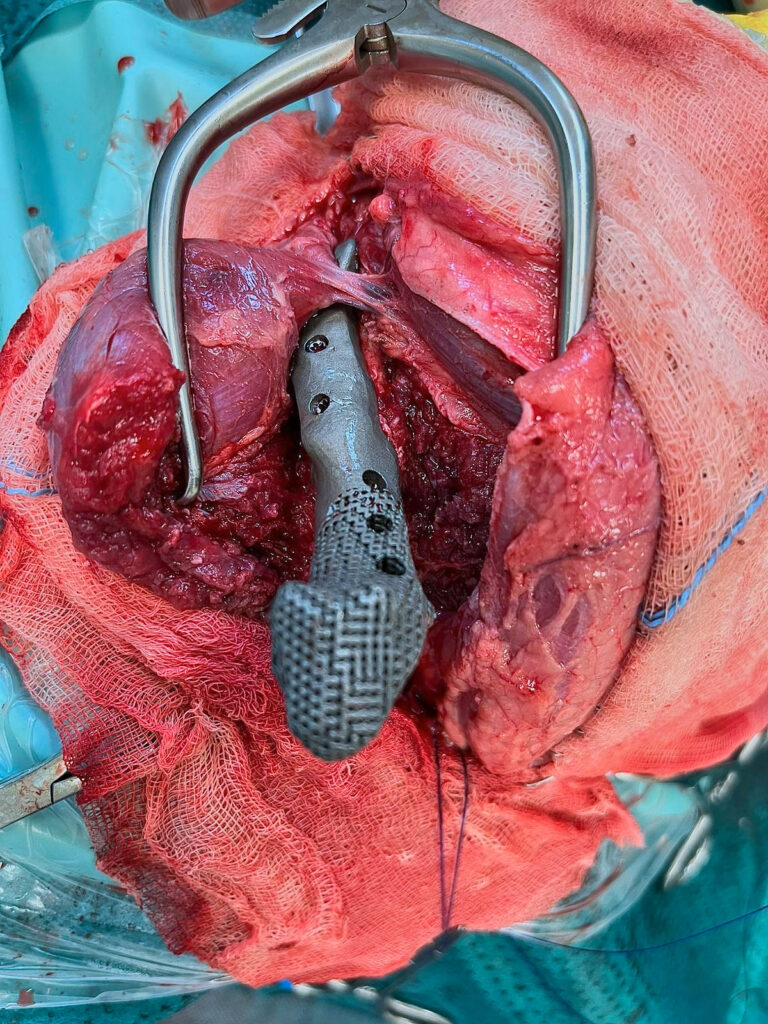 Implantat